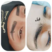 فیبروز میکرو شیدینگ