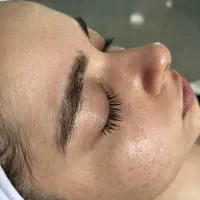 پاکسازی پوست اقتصادی