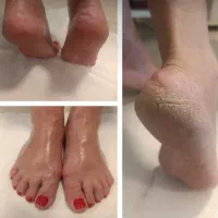 پدیکور سهروردی ژلیش کاشت پا پدیکورvip