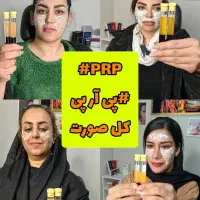 تزریق بوتاکس فیلر ژل پی آر پی نخ  صورت بینی