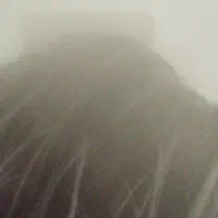 راهنمایی برای ریزش مو