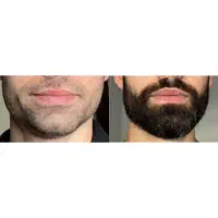 هر پسری پسر نیس چون ریش نداره