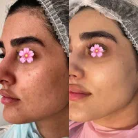 تخفیف فیشال تا آخر هفته