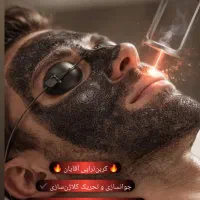 لیزر|خدمات آرایشگری و زیبایی|همدان, |دیوار