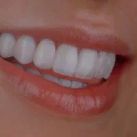 کامپوزیت،لمینت،ایمپلنت مراقبت از سلامتی