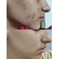 کرم سفید کننده عربی