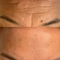 کرم بیوممتیک ۱۲ کاره برای لیفت پوست و جوانسازی