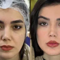 پکیج کانتورینک فول فیس نچرال