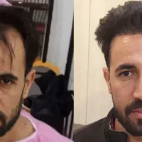 اولین و باسابقه ترین کلینیک کاشت مو در یزد