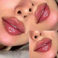 تزریق فیلر520هر یک سی سی آف خورده درجه یک
