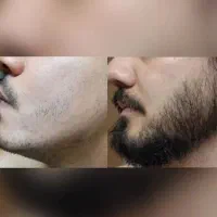 رویش از ریش زیبایی تاهمیشه