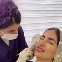 تزریق بوتاکس صورت با بیمه تامین اجتماعی مطب پزشکی