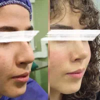 کلینیک جراحی بینی (اقساط سه ماهه) در شیراز