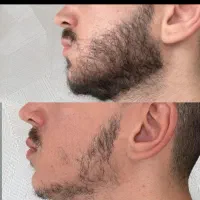 به ریش خودت برسید و لذت رویش مجدد رو ببینید