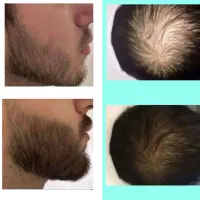 ریش و مو و سبیل  بهترین پک در جهان تضمینی
