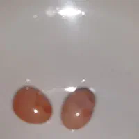 مهره کهرب و یک جفت مهره عقیق یمنی