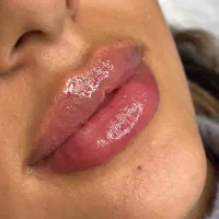 آکادمی آموزش فیلر و بوتاکس و زیبایی پزشکی