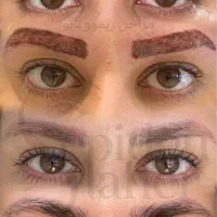 ریموو تاتو بدون آسیب / ابرو - خط چشم - خط لب-بدن