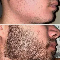 ریش پر پشت برای تو