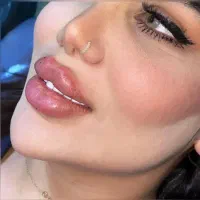 جالپرو بوتاکس ژل فیلر نخ لیفت پی ارپی مزو پروفایلو