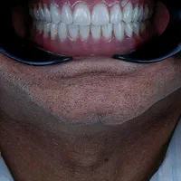 لابراتوار دندان مصنوعی