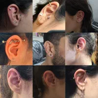 کلینیک زیبایی انجام تمام خدمات