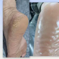کفسابی پدیکور