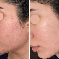 پن گیاهی بیوممتیک