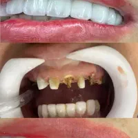 دندانپزشکی  (از دم قسط) قرارداد با تمام بیمه ها