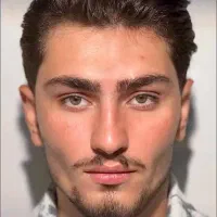 تنهامرکزتخصصی بلفاروپلاستی لیزری مشهدبادستگاه