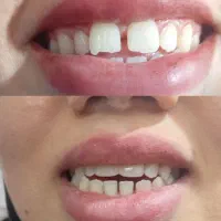 دندان|خدمات آرایشگری و زیبایی|کارون, |دیوار