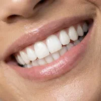 ارتودنسی دو فک با ضمانت نامه کتبی