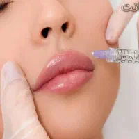 مدل ژل و بوتاکس