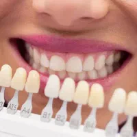 دوره جامع آموزش دندانسازی (از پایه تا پیشرفته)