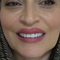 دندان مصنوعی