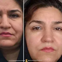 مشاوره وارسال رایگان