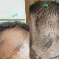 روغن گیاهی برای پوست و مو شما
