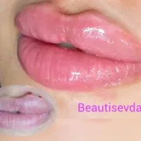 جشنواره فیلر بوتاکس مزو لاغری پیرسینگ میکرودرمال