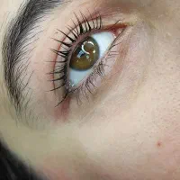 لیفت و لمینت/موخوره گیری تخصصی