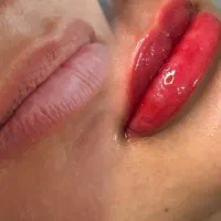 ترمیم رایگان،رژلب دائم،میکروبلیدینگ،خط چشم،بن مژه