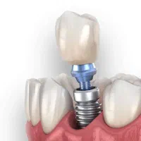 استخدام دستیار و  منشی دندانپزشک
