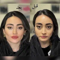کانتورینگ فول فیس ۳۴۵۰ فیلر کره ای