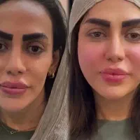مرکزتخصصی فیلر باسن بیکینی، ژل لب روسی،مزو،پی ارپی