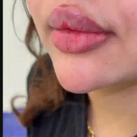 اف انجام ژل بابهترین مواد