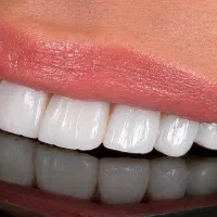 دندانپزشکی دکتر فربد تمام دیجیتال