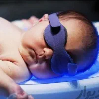 اجاره دستگاه زردی نوزاد(نمایندگی مرکزی فردیس)