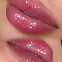 تخفیف ژل و بوتاکس و فیلر بینی