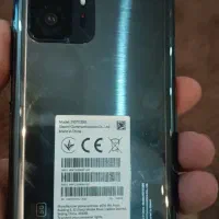 شیا عومی 11t pro