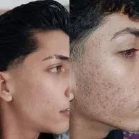 مشاورپوست و‌مو