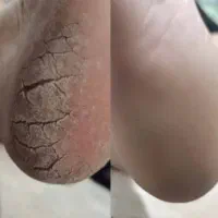 پدیکور واسپای دست و پا تخصصی